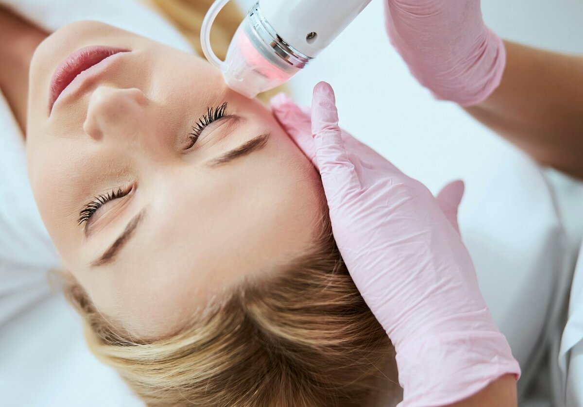 Микроигольчатый RF лифтинг